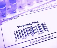 Laboratory specimen and medical chart